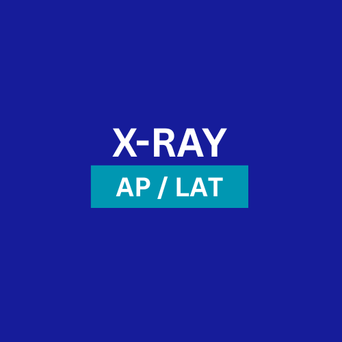 X-Ray :  AP / LAT - One Leg / Hand