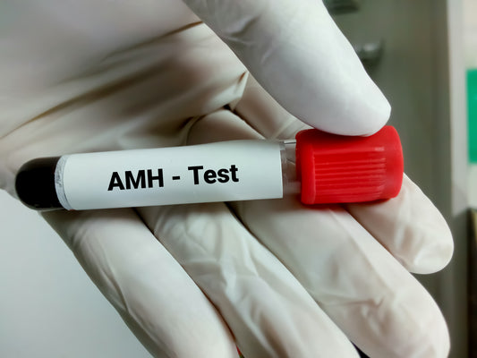 AMH - Anti-Mullerian Hormone