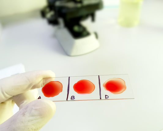 BLOOD GROUPING AND RH TYPING