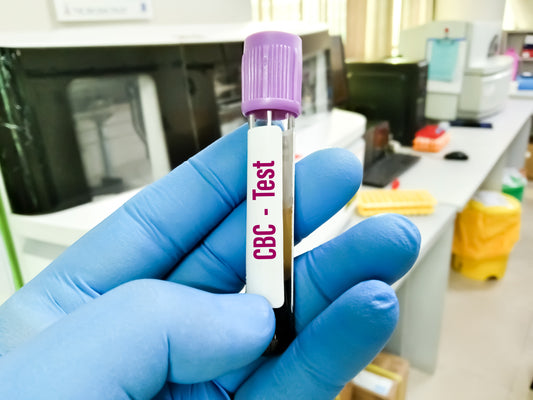 CBC - Complete Blood Count