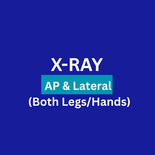 X-Ray : AP & Lateral (Both Legs/Hands)