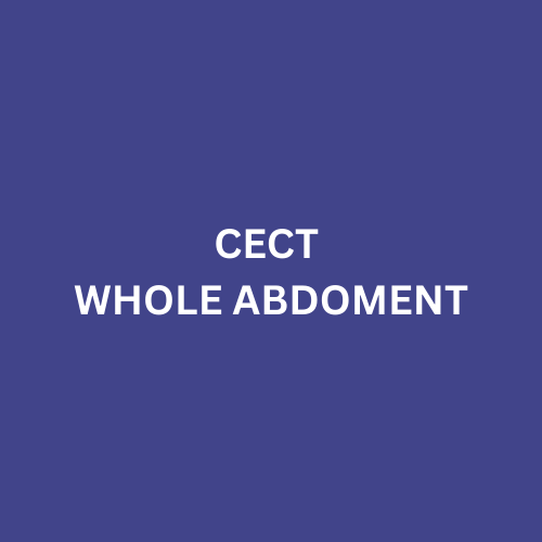 CECT WHOLE ABDOMEN
