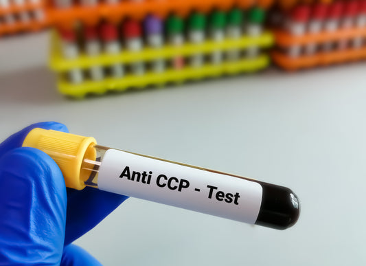 Anti CCP (ACCP)