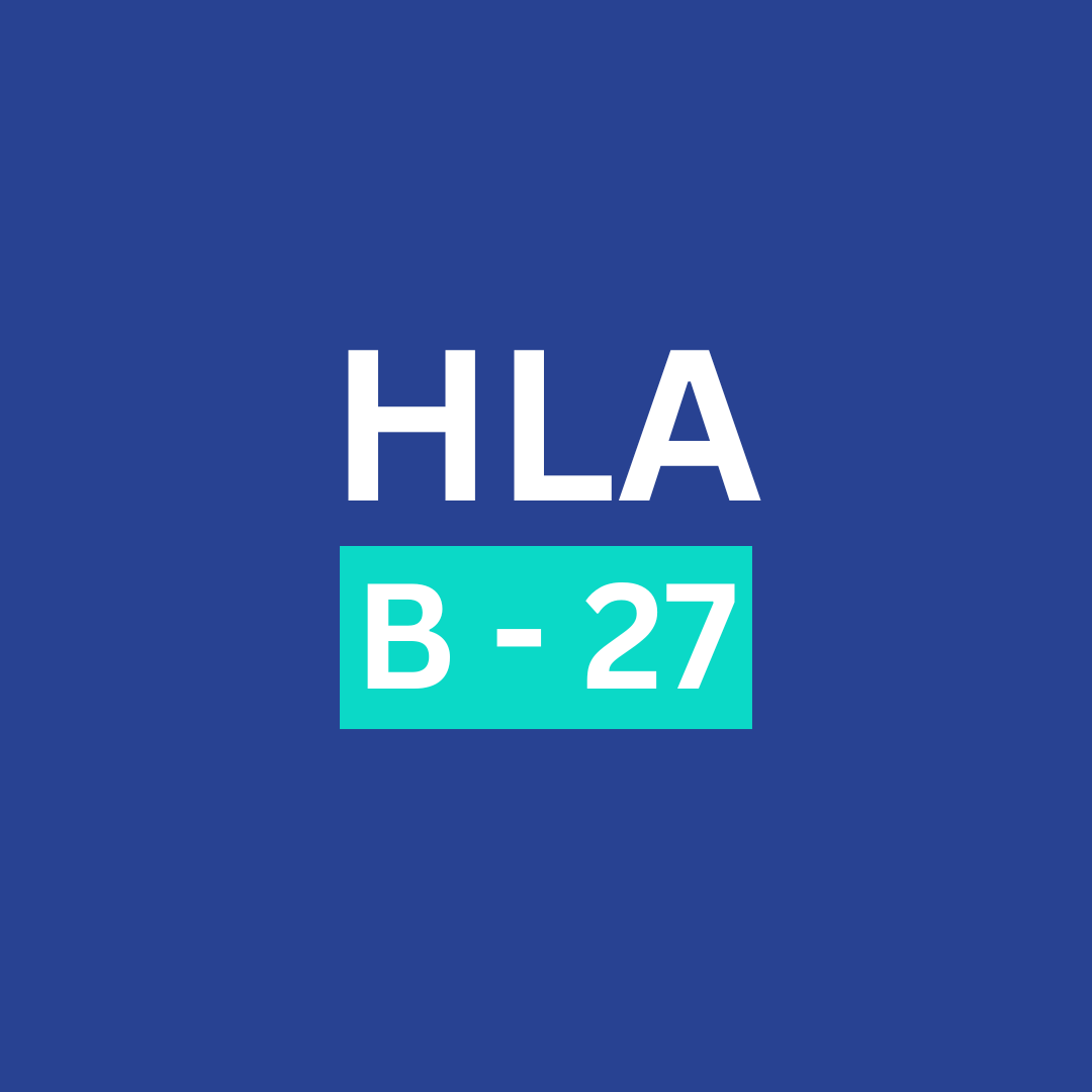 HLA - B27 STUDIES(PCR) - QUALITATIVE