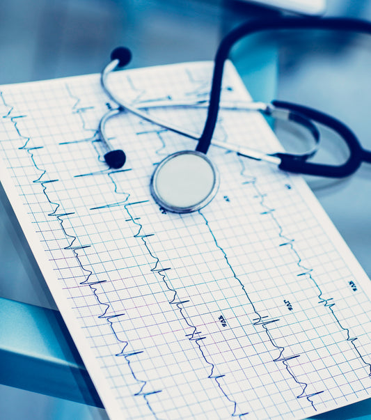 ECG